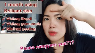 1 month using brilliant skin rejuvenating set [upl. by Harrad]