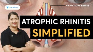 Atrophic Rhinitis Simplified  ENT with Dr Vyshnavi Jajee [upl. by Assertal860]