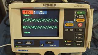 PhysioControl LIFEPAK 2020e Alarms [upl. by Assilev]