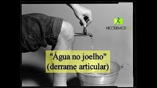 quotÁgua no joelhoquot derrame articular [upl. by Crystie]