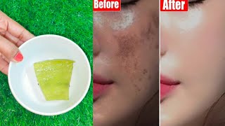 Aloe vera gel for glowing skin for dry skin  How to use aloe vera gel on face  Aloe vera gel [upl. by Rockie994]