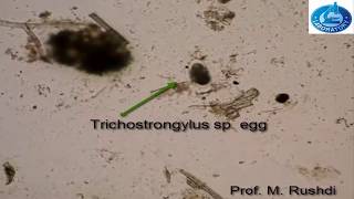 Simple and easy method for detection of eggs in feces [upl. by Elacim]