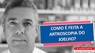 5 motivos para você fazer artroscopia do joelho [upl. by Aymik]