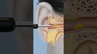 Wireless Visual Ear Pick [upl. by Gaal571]