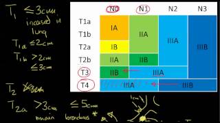 Lung Cancer Staging 7th edition AJCC [upl. by Rebmetpes]