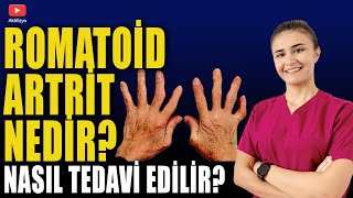 ROMATOİD ARTRİT NEDİR TEDAVİ NASIL YAPILIR [upl. by Shaughnessy]