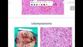 MSS pathology lab 1  part 4 [upl. by Macri496]