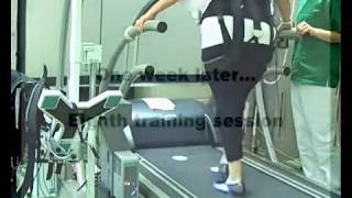 Parkinsons patient visual cueing gait training unweighting at LMU Munich [upl. by Avid994]