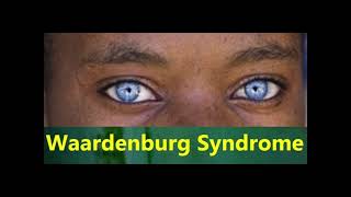 Waardenburg syndrome eyes [upl. by Jennine]