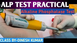 ALP Alkaline Phosphatase Test practical video in hindi [upl. by Idac]