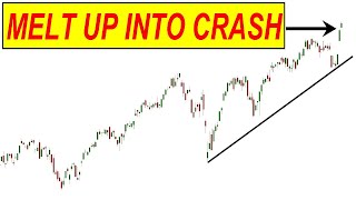 MELT UP Starting BUT It Will Lead Into Recession and CRASH [upl. by Steward]