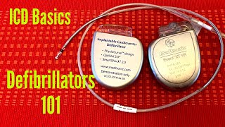 Defibrillators 101  The Basics Of An Implantable Cardioverter Defibrillator ICD [upl. by Chloras971]