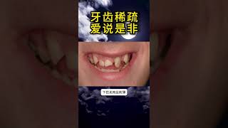 牙齿稀疏爱说是非 传统文化 面相physiognomy [upl. by Phillie]