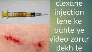 clexane injection in pregnancy [upl. by Atter]