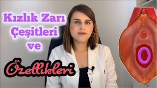 Kızlık Zarı Nerede  🟡 Çeşitleri Tipleri Şekilleri ve Özellikleri  Op Dr Funda Yazıcı Erol [upl. by Aneehsor]