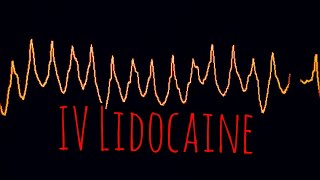 Prolonged Field Care Podcast 159 IV Lidocaine for Acute Pain [upl. by Fisa557]