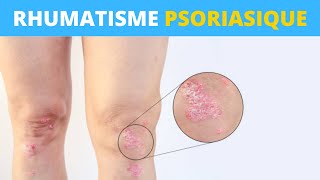 Le rhumatisme psoriasique expliqué en 1 minute [upl. by Innavoij]