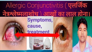 Allergic Conjunctivitis  एलर्जिक नेत्रश्लेष्मलाशोथ Abhia2zmedicalSymptoms cause treatment [upl. by Jollanta765]