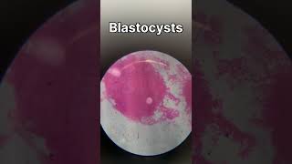 TS of ovary  TS of testis  ringworm bacteria under microscope biology animalkingdomclass11 [upl. by Latihs493]