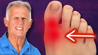 BIG Toe Pain RELIEF amp Walk Normal Again Hallux Rigidus [upl. by Aicelet]