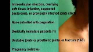 Subacromial Shoulder Joint Injection [upl. by Atinal]