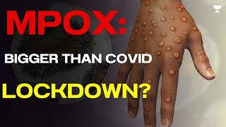 Mpox Virus EXPOSED Shocking Facts You Must Know  The Ultimate Guide to Prepare for UPSC CSE CAPF [upl. by Naaman926]