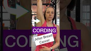 Get Rid of CORDING Axillary Web Syndrome breastcancer [upl. by Ilil436]