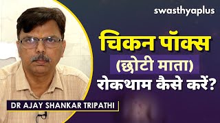 चिकन पॉक्स की रोकथाम कैसे करें  Symptoms of Chickenpox in Hindi  Dr Ajay Shankar Tripathi [upl. by Abisha]