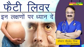 Fatty Liver इन लक्षणों पर ध्यान दे  SYMPTOMS NON ALCOHOLIC FATTY LIVER DISEASE [upl. by Kirad306]