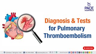 Diagnosis of Pulmonary Thromboembolism  pulmonaryembolism [upl. by Oirasec279]