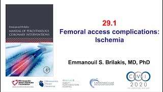 291 Ischemic femoral access complications  Manual of PCI [upl. by Siulegroj]