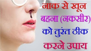 नाक से खून बहना नकसीर की समस्या से तुरंत छुटकारा पाने का घरेलु उपाय  Home Remedy For Nose Bleed [upl. by Suryc]