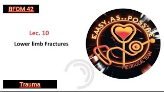 Lecture 10  Lower Limb Fractures  Trauma 42 [upl. by Jenesia]