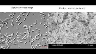 What do bacteria look like under a light vs electron microscope [upl. by Martens]