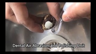 The Amazing Effect of Dental Air Abrasion and Polishing Unit [upl. by Suiratnauq]