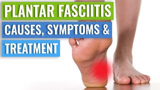 Plantar Fasciitis Causes Symptoms amp Treatment [upl. by Nunes]