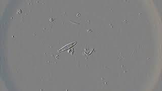 Diatoms in action [upl. by Stoops]