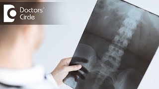 When do one need to go for Spinal Fusion  Dr Kodlady Surendra Shetty [upl. by Enitram]