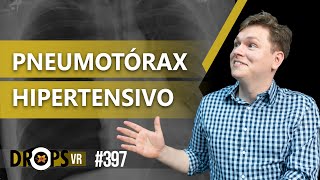 PNEUMOTÓRAX HIPERTENSIVO  COMO IDENTIFICAR NO RX [upl. by Nilad]