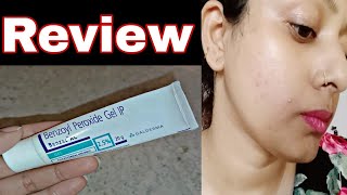 Benzoyl Peroxide Gel 25 how to use benzoyl peroxide pimple cream pimple benzoylperoxide [upl. by Anitsyrhc]