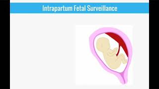 Intrapartum fetal monitoring everything explained [upl. by Eelak]