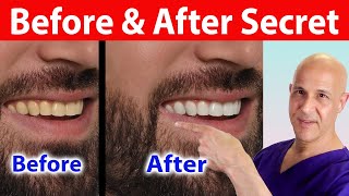 This Secret Fruit Whitens Teeth Instantly—You’ll Be Amazed Dr Mandell [upl. by Dammahum]