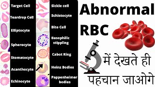 RBC Anomalies  RBC Abnormal Morphology  Inclusion bodies under microscope 🔬 [upl. by Longmire]