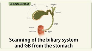 Scanning of the biliary system from the stomach [upl. by Keele207]