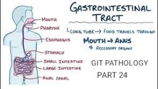 Intestine  ischemic bowel disease and haemorrhoids git pathology intestines [upl. by Oneg]