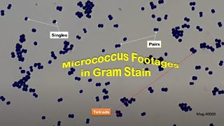 Gram positive cocci in singles pairs and terads of Micrococcus under the Microscope [upl. by Ly490]