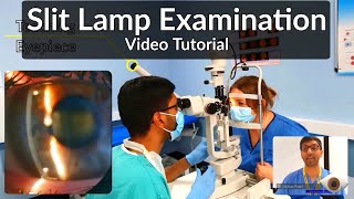 Slit Lamp Exam Tutorial  Part 1 [upl. by Giles90]