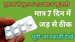 Dad Ki Dawa  सिर्फ 7 दिन में दाद खाज खुजली जड़ से ठीक  Terbicad 250 Tablet  dad ki dawai [upl. by Yordan679]