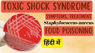 Toxic shock syndrome in Hindi  Toxic shock syndrome symptoms and treatment [upl. by Bez]