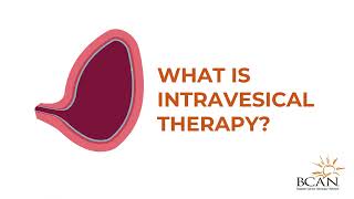 What is Intravesical Therapy  Bladder Cancer Advocacy Network [upl. by Wistrup]